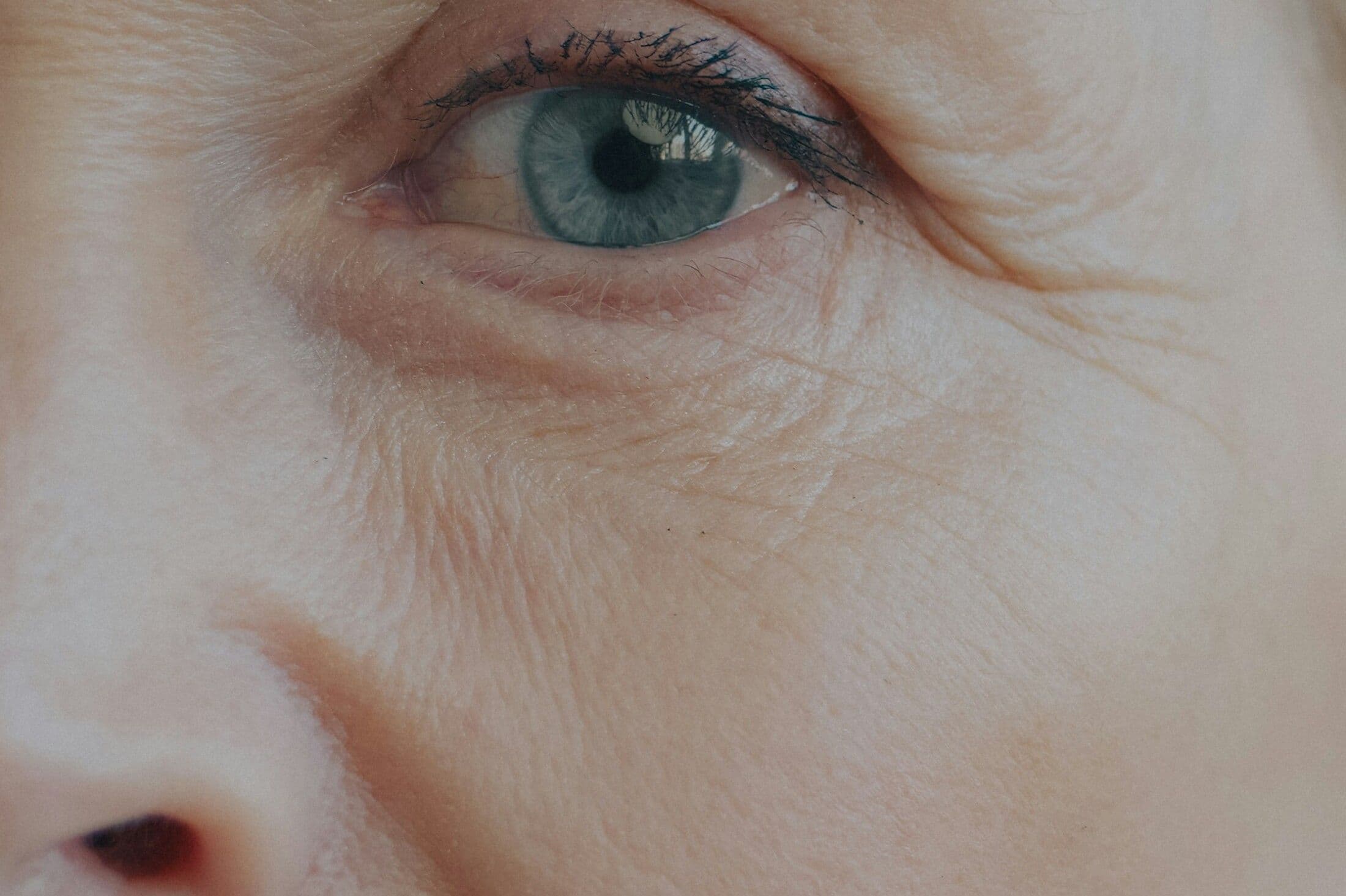 Micro-lipofilling du visage à Bordeaux