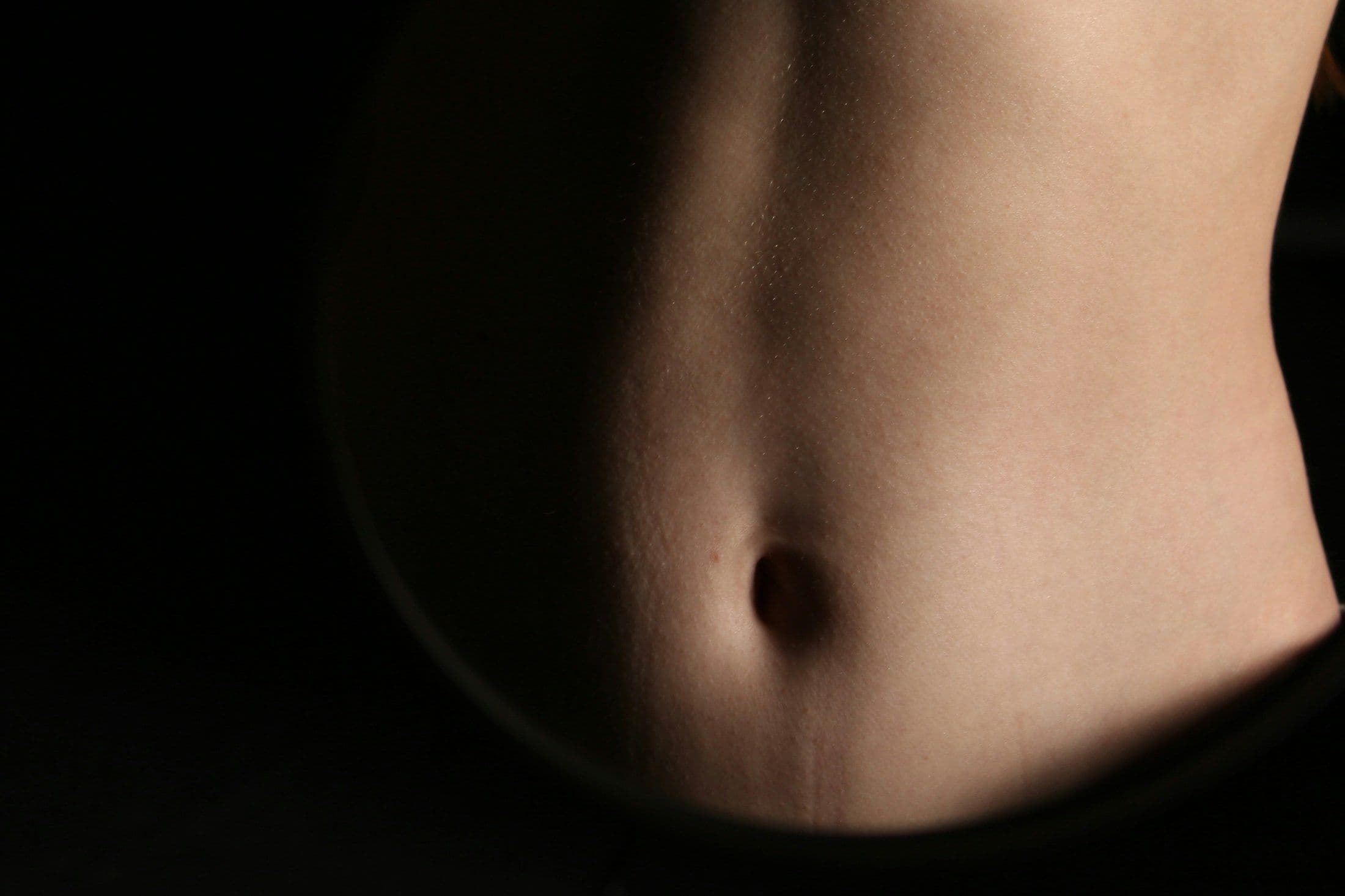 Mini tummy tuck