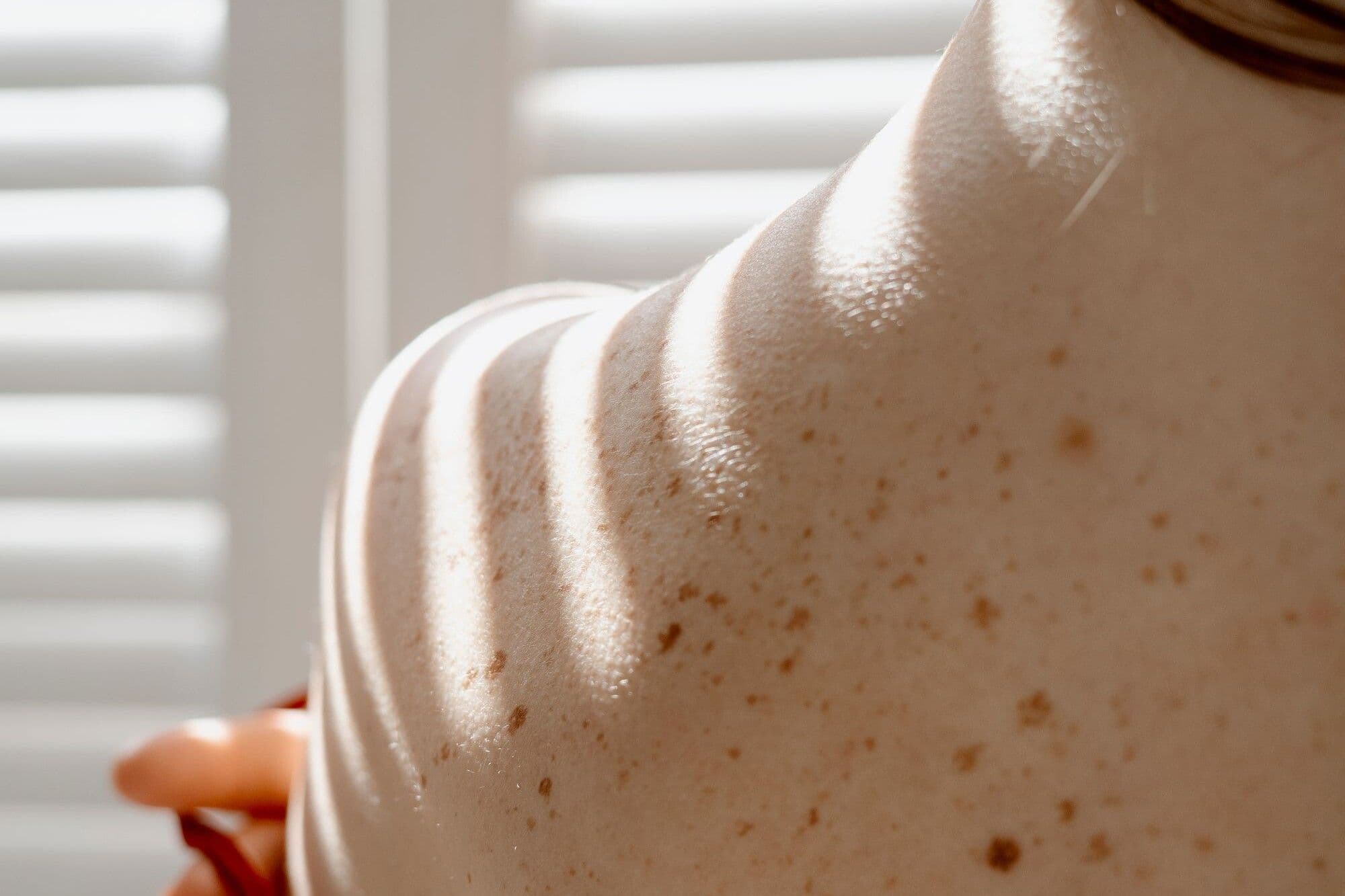 Skin surgery