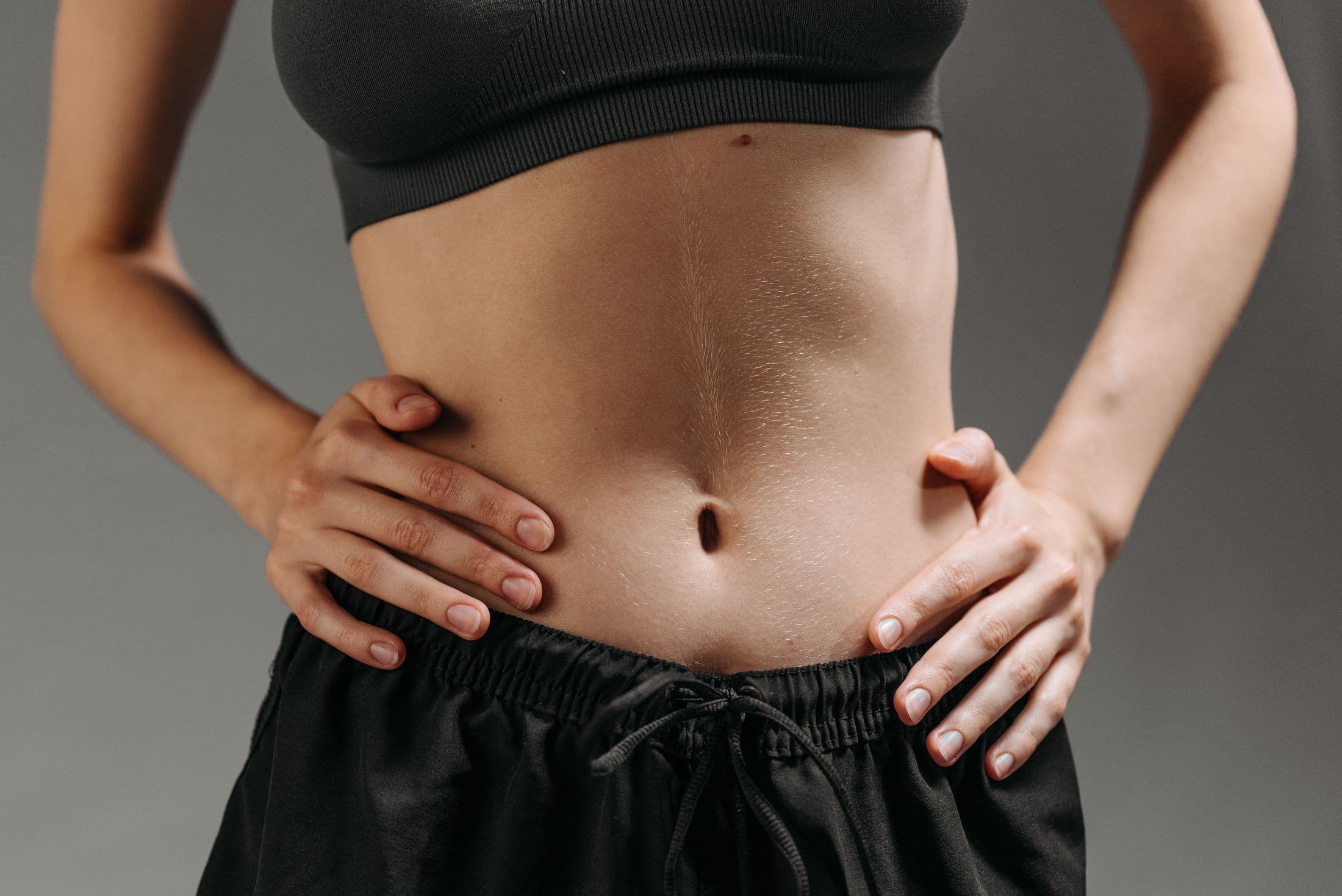 Tummy tuck